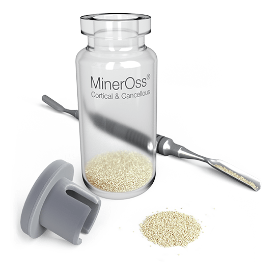 BIOHORIZONS MinerOss Blend