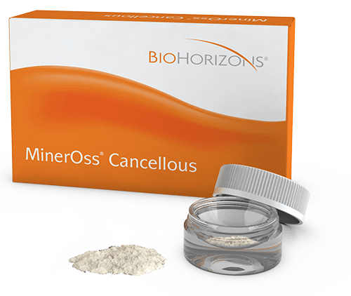 BIOHORIZONS MinorOss Cancellous