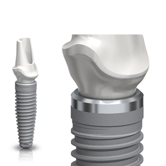 NobelReplace Conical Connection